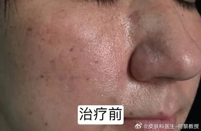 (易液化的气体沸点高还是低)易液化说明沸点高还是低：易液化物质通常具有较低的沸点。